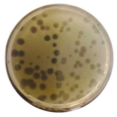 Borderline number of plaques which can be counted and evaluated.