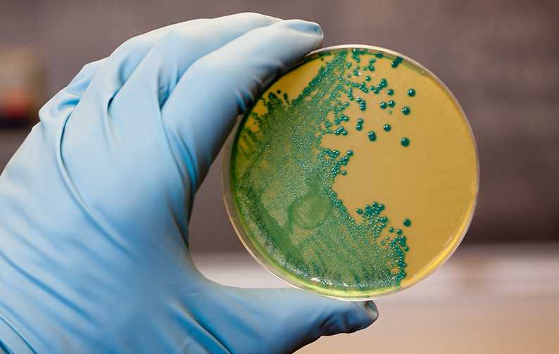 Bacteria Listeria